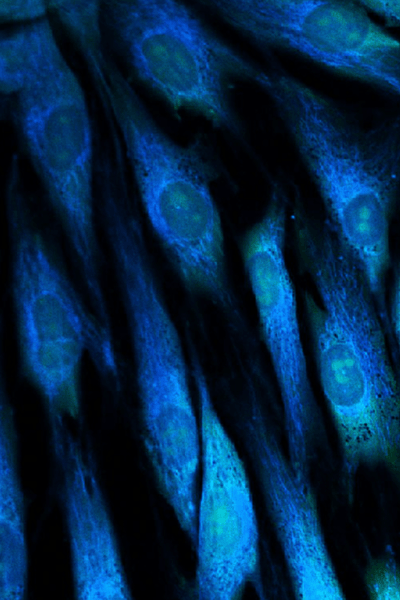 Fibroblast