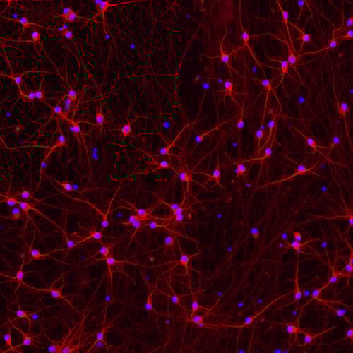Human iPSC-derived Parkinson's disease model